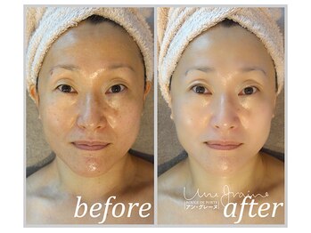 アン グレーヌ 自由が丘(unegraine)/ハリツヤふっくら…美しさの条件