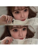 マイペティラ(my.petilla)/miyu matuge