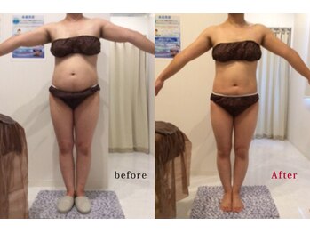 アネル 豊見城(anel)/