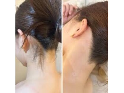 グレイス(GRACE)の写真