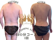 ビハーラ 門司店/3ヶ月で結果出し痩身リンパ/門司