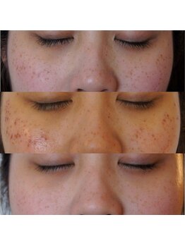 ザ シー タイムレスビューティ(THE SHE)/20代お客様症例写真