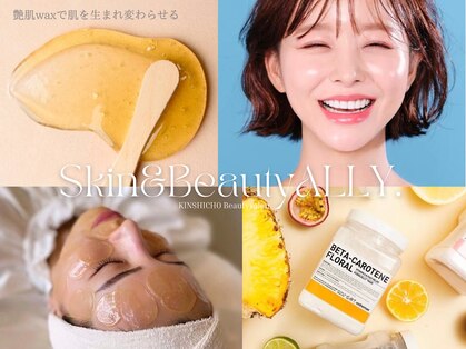 アリー(ALLY)の写真