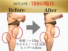 エステブース♪痩身・フェイシャル・整体と豊富なメニュー多数★