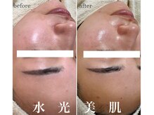 モンクラッシー(Mon classy)