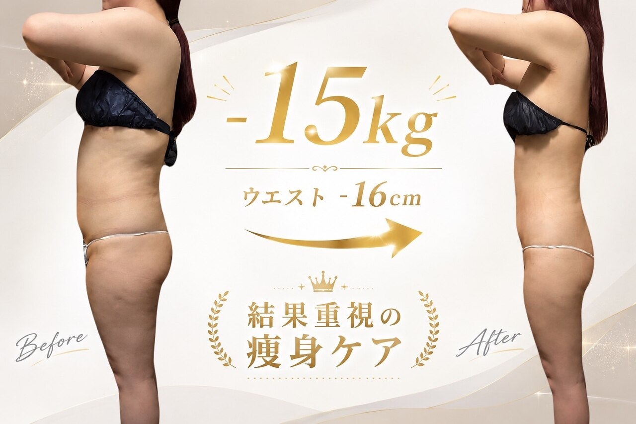 水戸市でキャビテーションが人気のエステサロン｜ホットペッパー
