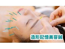 ディア(Deer)/究極の造形記憶美容鍼♪