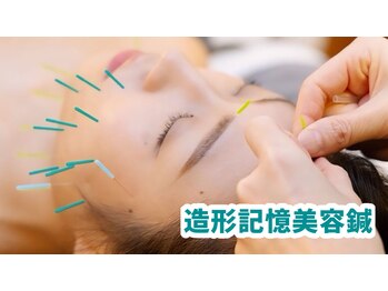 ディア(Deer)/究極の造形記憶美容鍼♪