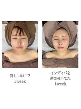 インディバケアプラチナム 横浜店/インディバ施術
