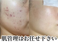 アンドピエル(AndPiel)の雰囲気（肌管理は当店にお任せください。）