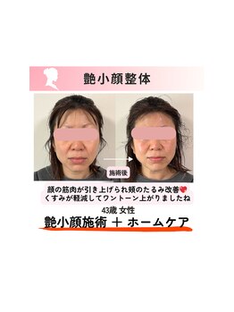 いたみいろどり整体院/美肌ヘッドスパ小顔整体
