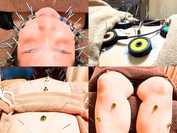 仁接骨院 じん鍼灸治療院の写真/【いくつになっても綺麗でい続けたい方へ】資格を持つベテランオーナーがあなたのお肌悩みに寄り添います!