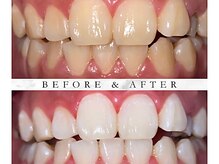 プラチナムビューティ 渋谷店(PLATINUM Beauty)