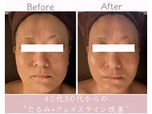 エービューティ(A.beauty)