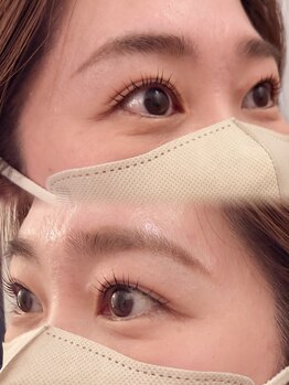 ノット(KNOOT)の写真/お悩みを丁寧にカウンセリングし、なりたいお目元をお伺い☆最適なデザインをご提案いたします♪