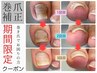期間限定価格【巻爪補正】巻爪にお困りの方募集！甘皮ケア付き1本￥3300