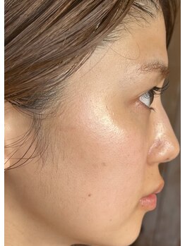 ノエビア ビューティスタジオ セレンディピティ(NOEVIR Beauty Studio Serendipity)/こんぶちゃん自慢のすっぴん肌！