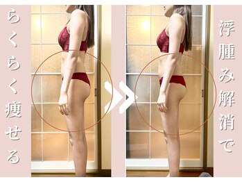 ヨサパーク エム(YOSA PARK 笑)/効果事例