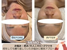 エマーチェ 自由が丘(emmace)