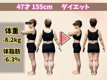 ほんじょう整骨院 美容整体/北九州/八幡西区/ダイエット