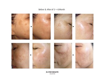 オトゥールボーテ(OToolBeaute)/