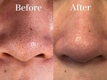 エミリエボーテ