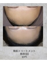 コンクパール(CONCH PEARL.)/陶肌トリートメント