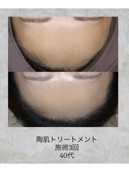 コンクパール(CONCH PEARL.)/陶肌トリートメント