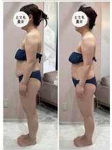 エーエフビューティーエステ(AF Beauty Esthetic)/骨盤から整える全身ケア