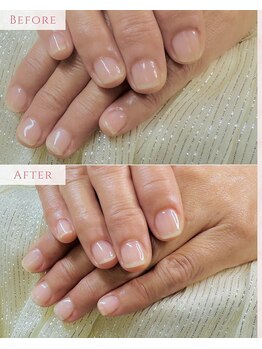 自爪育成ケア×ジェルコース