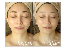 アン グレーヌ 自由が丘(unegraine)/シャープな輪郭＆丸みのある頬に