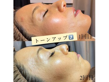 レディエント(RADIANT)