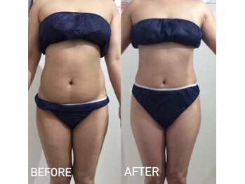 マジョラム(Marjoram)/お腹周り