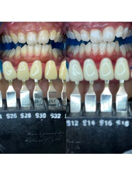 トウキョウスワーズ 池袋店(TOKYO SWRS)/#ホワイトニング #池袋 #渋谷