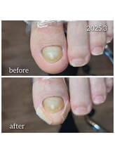 爪切り屋 足楽/