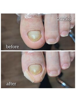 爪切り屋 足楽/