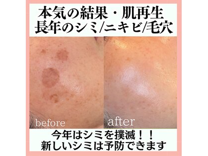 リアリア(LEALEA)の写真