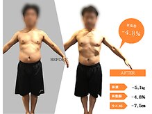 ジーサルース(Gサルース)/A様（４０代）【２カ月】　前