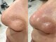 リブロウ 三軒茶屋店(REBROW)の写真/【メンズ専門店】毛穴の黒ずみ角栓ごっそりフェイスワックス＋ハリウッドブロウリフトで劇的印象チェンジ!!