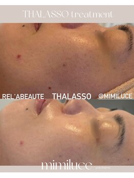 ミミルーチェ(mimiluce)/毛穴No.1タラソハーブピーリング