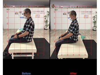 ストレチックス 近江八幡店/ストレッチ ビフォーアフター