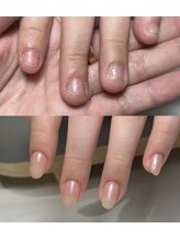 リリ(Rili)/深爪矯正/自爪育成