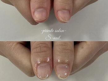 エスネイル 天王寺店(S-nail)の写真/【深爪矯正・自爪育成専門】爪を隠す毎日はもう卒業!丁寧なケアで悩み解消。見せたくなる美しい指先へ♪