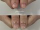 エスネイル 天王寺店(S-nail)の写真/【深爪矯正・自爪育成専門】爪を隠す毎日はもう卒業!丁寧なケアで悩み解消。見せたくなる美しい指先へ♪