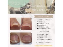 ネイルサロン エルフィン(Nail salon elfin)の雰囲気（巻き爪補正も可能◎定額ネイルも付け放題も選べてうれしい♪）