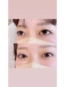 ルラン(luran)/上下ラッシュリフト