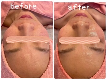 ヒメミ(Himemi)/艶肌Wax