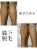 ¥16500→¥6000半額以下でお試し☆キッズ全身脱毛(顔・VIOなし)