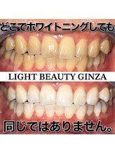 ライトビューティー 銀座店(LightBeauty)/東銀座　ホワイトニング症例写真