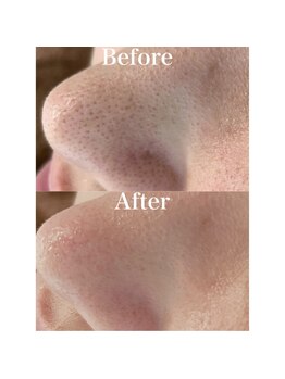 ペイジ(peige)/【peige】症例写真